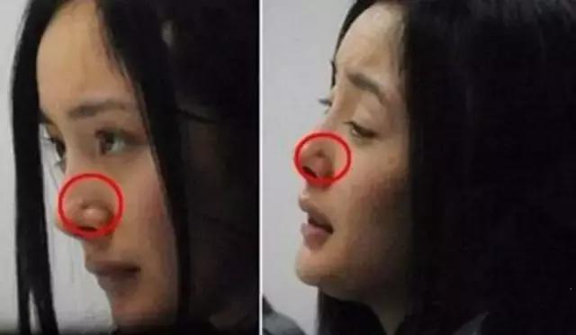 治痘痘烂脸的产品,祛痘印闭口效果最好的产品测评