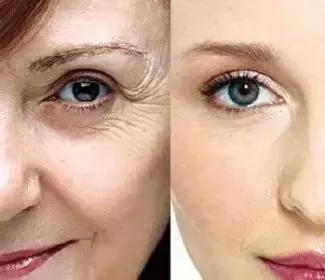 明星达人都爱的一款补水玻尿酸,玻尿酸补水美白抗衰老