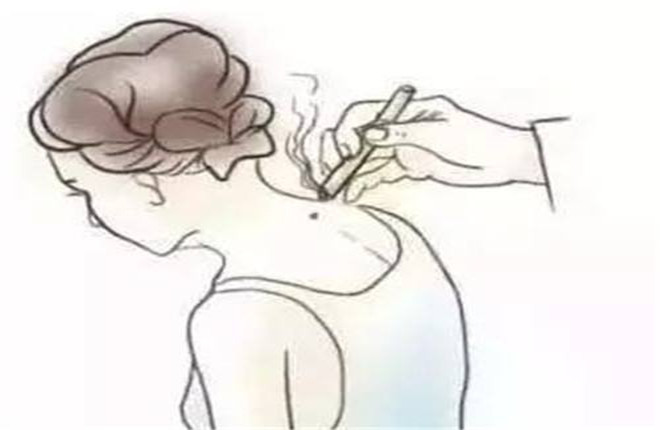 脖子下方有富贵包应注意哪些事项,孩子脖子后面有富贵包是怎么回事