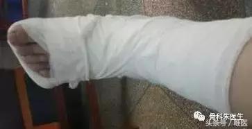 骨科脚踝扭伤怎么快速恢复,医生会怎么处理脚踝扭伤