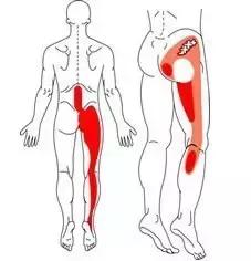 坐骨神经痛只需一招根除,腰间盘突出坐骨神经痛怎么治疗好