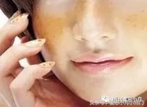 脸上突然长大块褐色斑怎么解决,男人脸上突然很多斑是什么原因