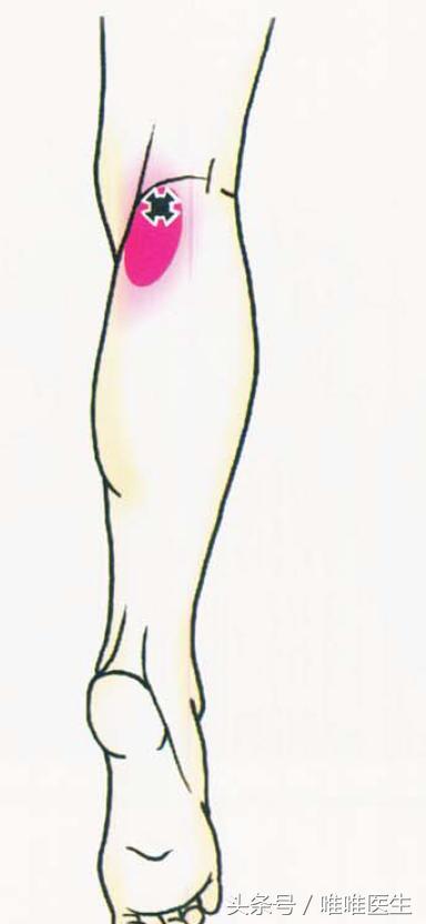 膝关节科普文章,膝关节疼痛最全解析