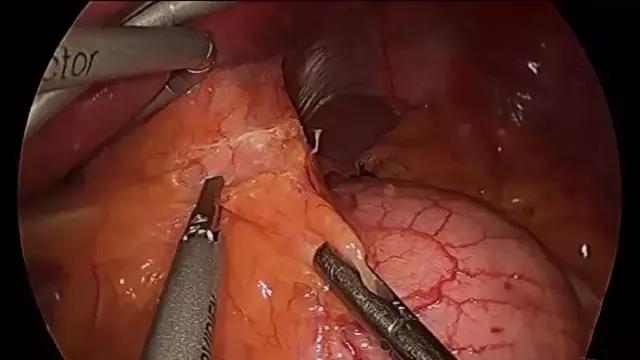 饮食拯救生命—连载之六——糖尿病（上）