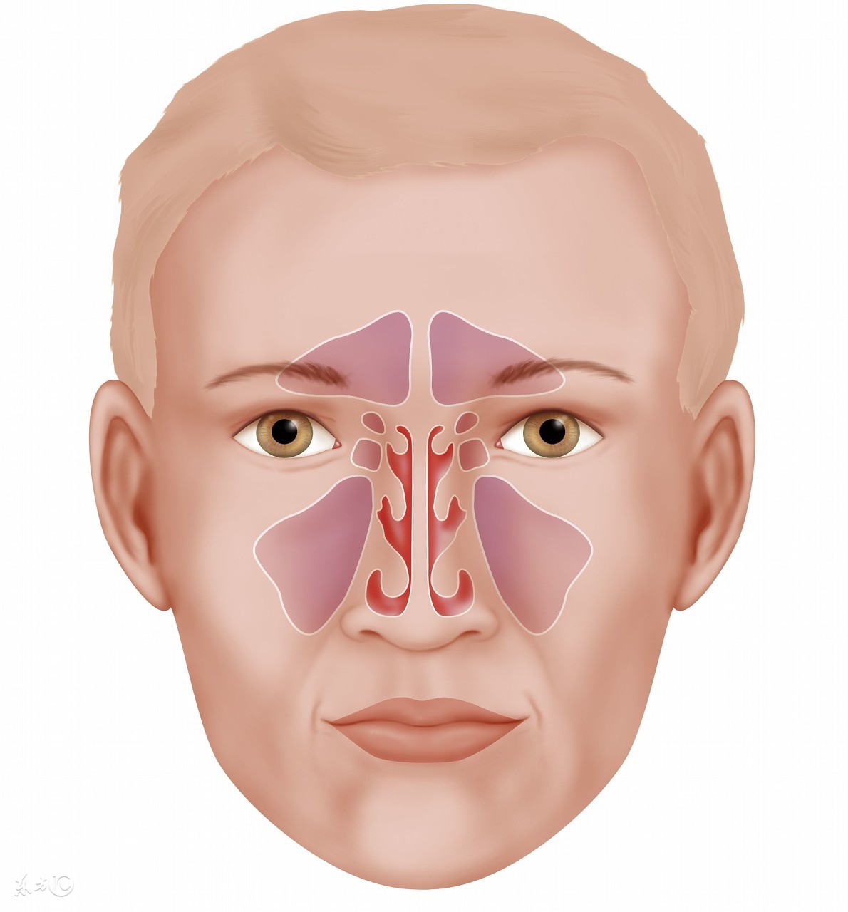 鼻炎鼻窦炎最佳的治疗方法,鼻炎鼻窦炎如何有效治疗