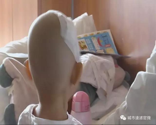 剪刀戳伤小朋友,剪刀戳伤孩子