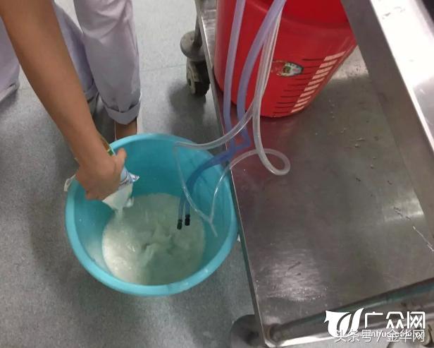 浙江一65岁大伯喝了口“水”医生用4箱牛奶给他洗胃