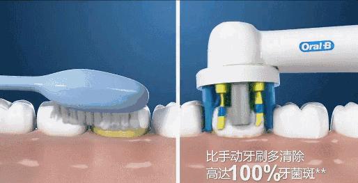 你知道蛀牙怎么形成,蛀牙到什么程度要做根管治疗