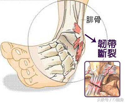 小腿肌肉磁共振解剖,小腿血管解剖图解