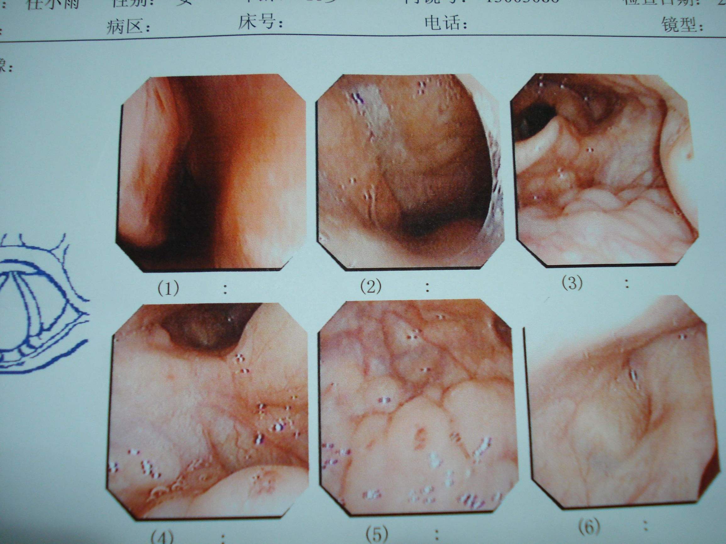 八个月宝宝头部突然红肿,40天婴儿出现猪毛风怎么办