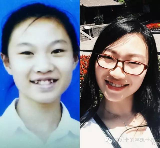 她们说||那些年整牙吞下的血和泪,终于换来最开怀的大笑