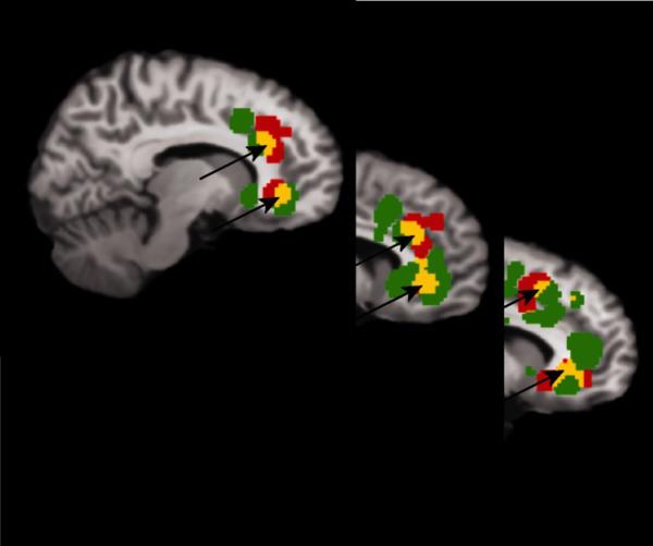 分手之痛是什么级别的痛觉,分手后心痛是什么原因