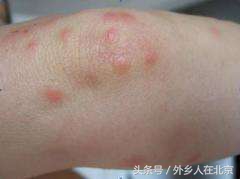 新房入住后有很小很小的虫子,新租的房子有特别小的虫子