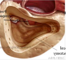 听力低频下降怎么恢复,低频听力下降耳鸣怎么治疗