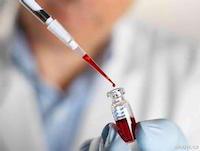 癌症血栓肺栓塞有痛苦吗,癌症相关的血栓发病率