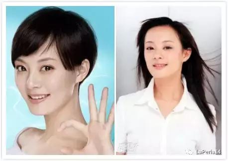 骨性方脸怎么瘦脸,方脸怎么改善脸型整骨