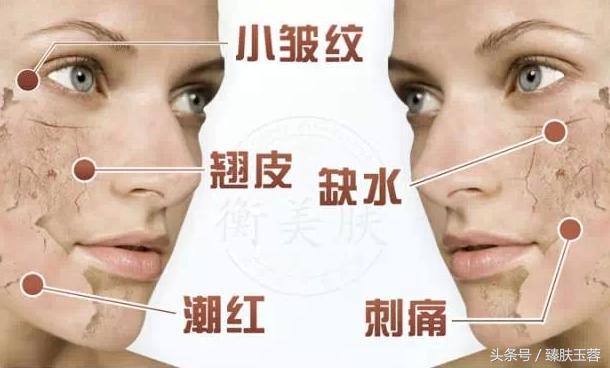 激素性皮炎用什么护肤品修复,激素皮肤过敏怎么治疗