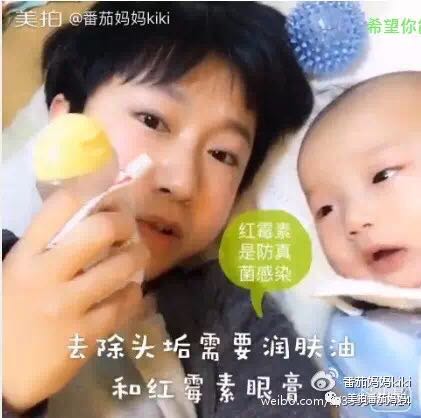 婴儿湿疹头垢洗了之后一直在出水,新生儿头垢和湿疹结痂的区别