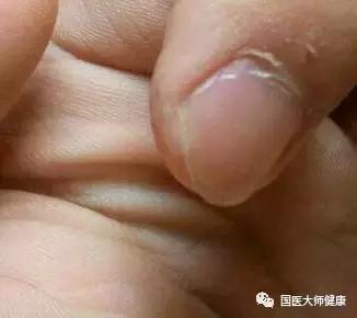 指甲上的月牙预示着什么,指甲上的月牙真的和健康有关系吗