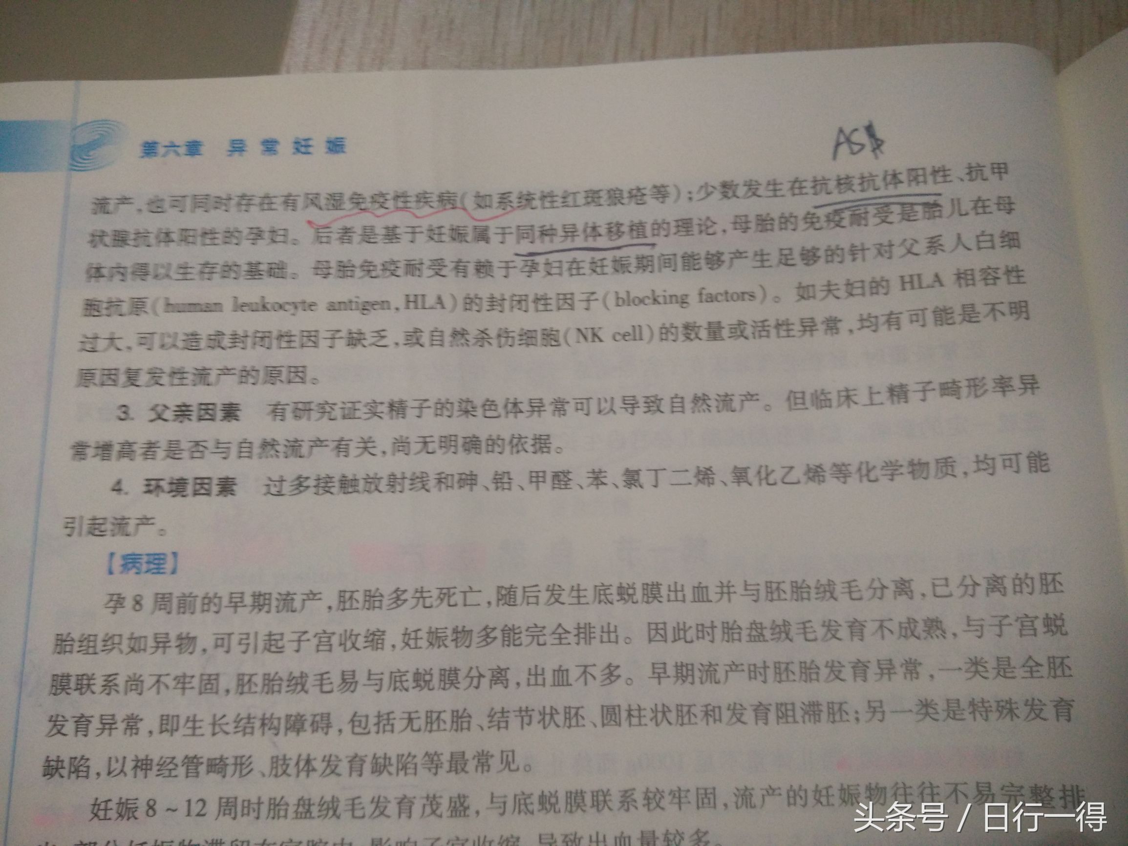 实习日志13：中晚期流产，竟然要经历生小孩一样痛苦的过程