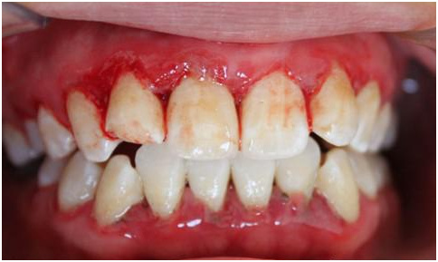 你和女神的距离就差一步,你与女神的距离只差一个下巴