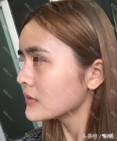 杨紫微整前后容颜对比,杨紫瘦了吗