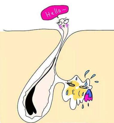 毛发移植的价格贵不贵呀,毛发移植贵不贵