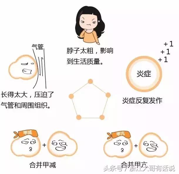 甲状腺结节是什么病,甲状腺结节是什么