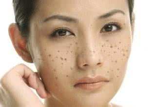 脸上的褐斑怎样调理才能淡斑,脸上的黄褐色斑怎么去除