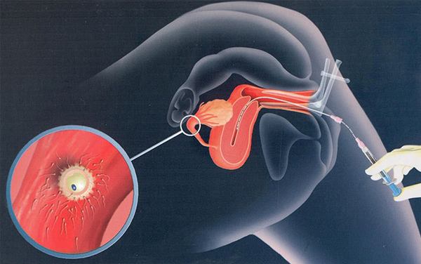 人工授精真的成功率很低吗,你真的了解人工智能吗翻译