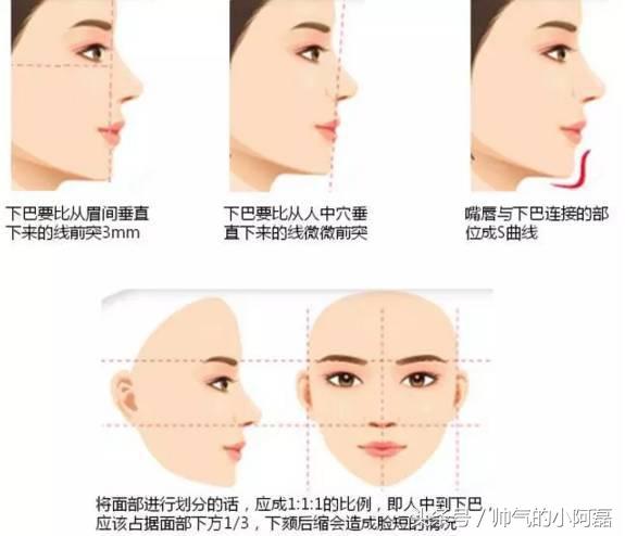 玻尿酸微整形丰下巴多少钱一针,下巴微整形要多少钱