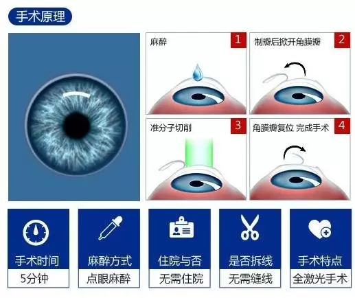 近视手术过程中是什么感觉,近视超过1000度还能做近视手术吗