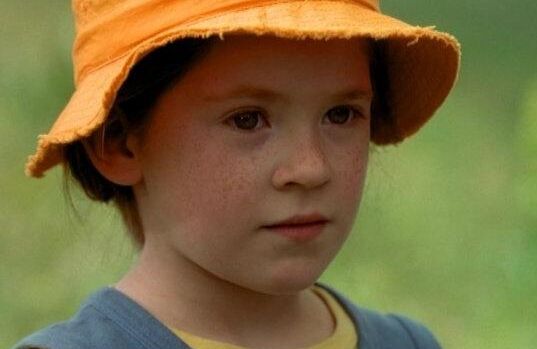 雀斑是什么原因引起的怎样去掉呢,雀斑应该怎么处理