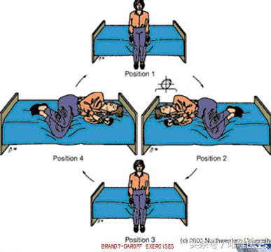 颈椎病引起的头晕怎么判断,头晕型颈椎病症状