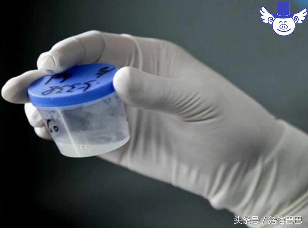 人工授精失败了是什么原因造成的,人工授精失败的原因是什么呢