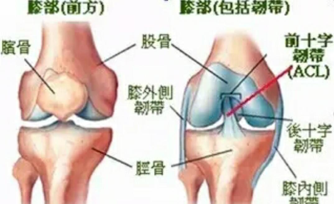 膝关节韧带损伤怎样好得快,膝关节韧带受伤怎么判断