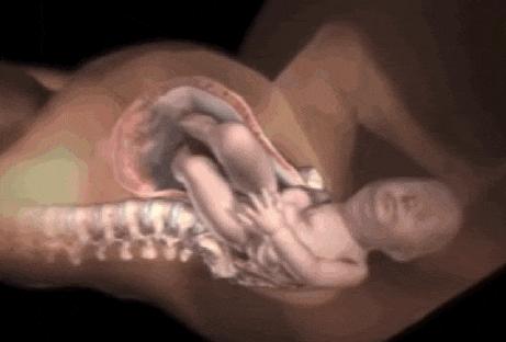 顺产就像断了18根肋骨,顺产真的是20根肋骨同时断裂吗