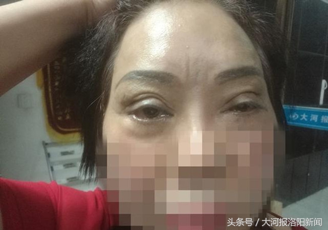 美容变毁容恢复后可以要求赔吗,美容变毁容索赔20万
