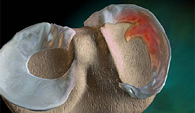 腿软是不是肾虚吃什么药,腿软是怎么回事外科大夫怎么说