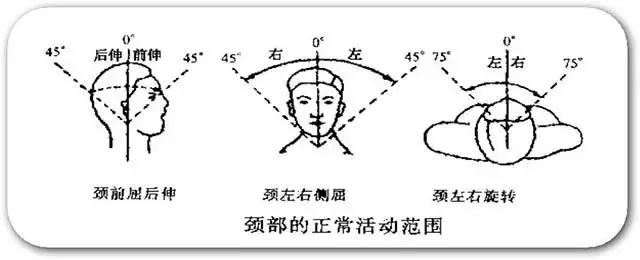 脖子疼痛是得颈椎病了吗,脖子疼不是淋巴也不是甲状腺