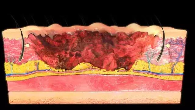 啊！没错，我今天要拯救你们的脸于水火之中！