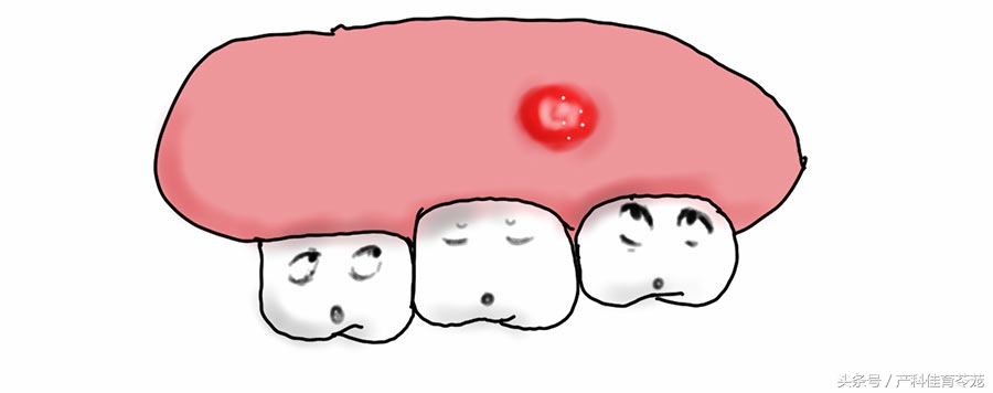 孕期检查口腔,孕期检查你到第几关了