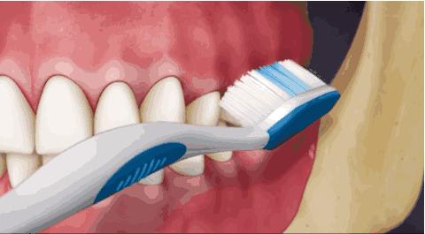 2岁宝宝牙齿龋齿很严重怎么办,大人帮着孩子刷牙还是龋齿怎么办
