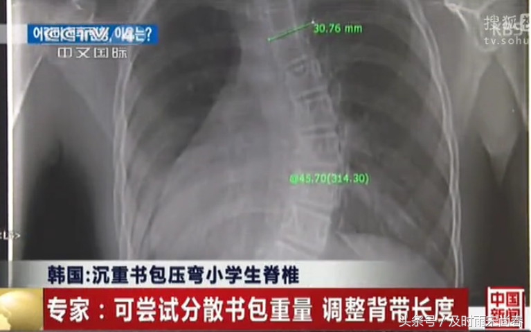 小事不小:莫让沉重的书包,压住孩子成长的脚步