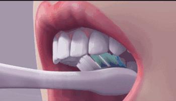 2岁宝宝牙齿龋齿很严重怎么办,大人帮着孩子刷牙还是龋齿怎么办