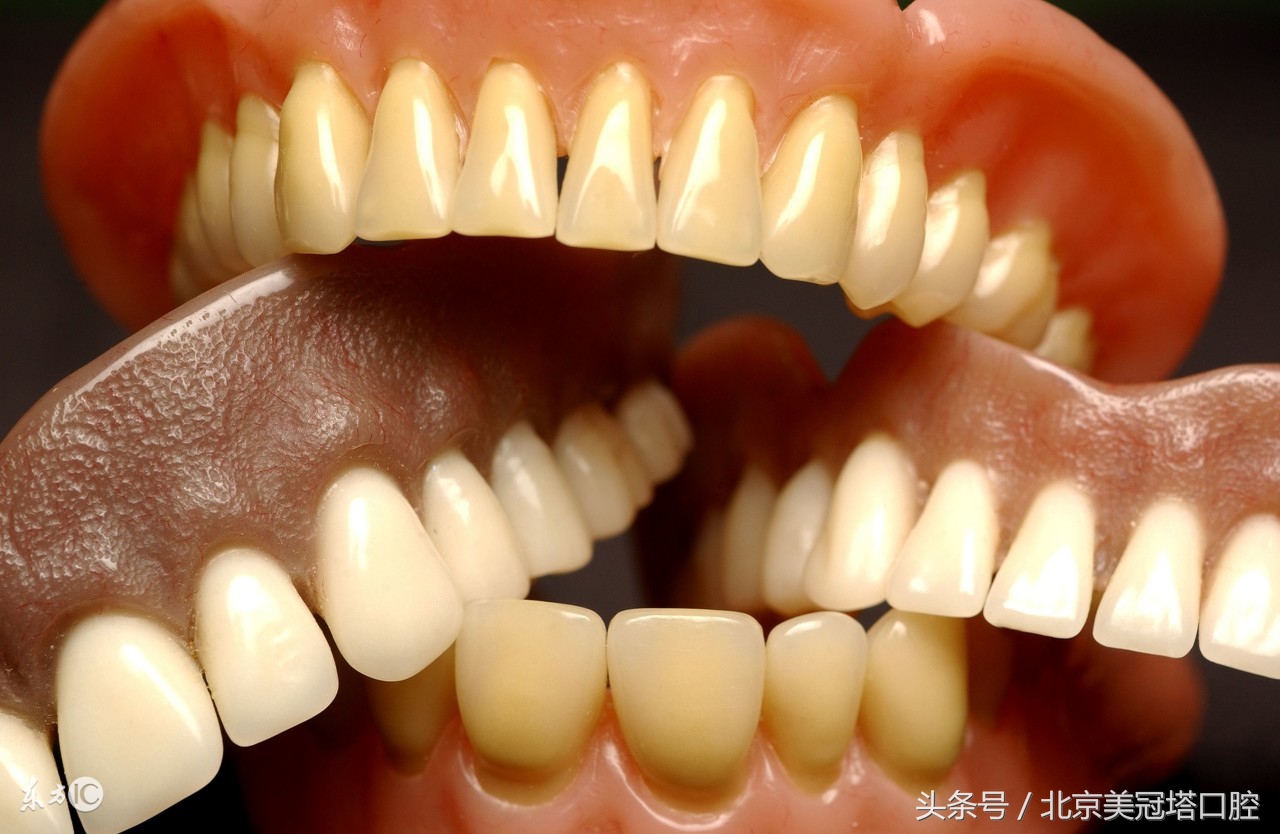 有一种毁容叫戴眼镜,牙齿正畸毁容案例