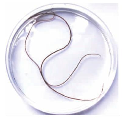 铁线虫真的能控制人体吗,铁线虫会入侵猫身体吗