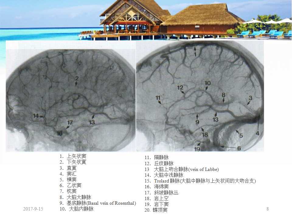 颅内静脉窦血栓形成怎么治疗,颅内静脉窦血栓形成最佳治疗方法