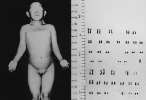 「助孕知识」染色体与卵巢的关系？！