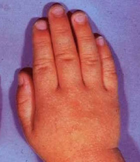 有乙肝的妈妈就要检测病毒载量吗,准妈妈携带乙肝病毒